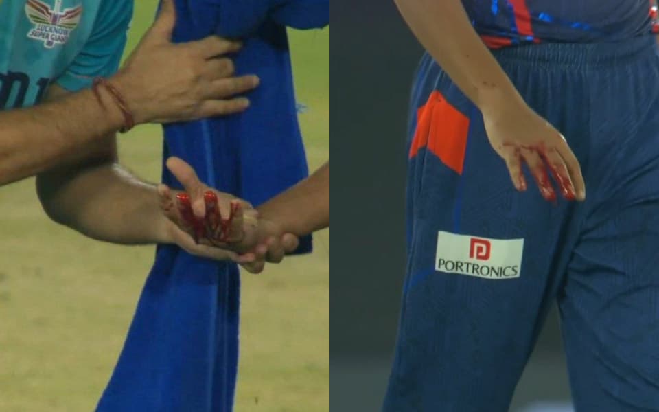 IPL 2025: Shubman Gill's fierce strike hits Akash Singh, suffers heavy bleeding